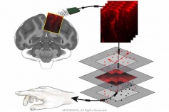 تکنولوژی جدید اولتراسوند فعالیت های مغزی را رمزگشایی میکند
