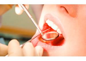 آینه دندانپزشکیمعرفی محصولات 