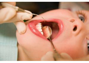 اسکیلر دندانپزشکیمعرفی محصولات 