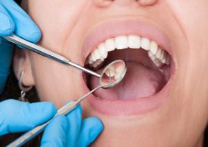 دندانپزشکیمعرفی محصولات 