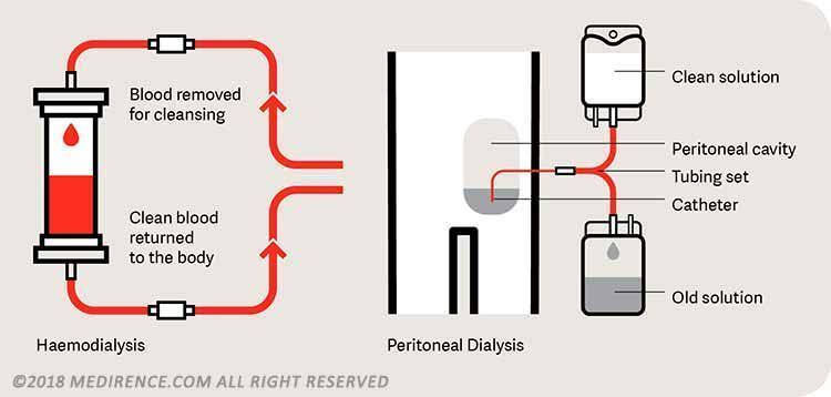 peritoneal-dialysis-units01