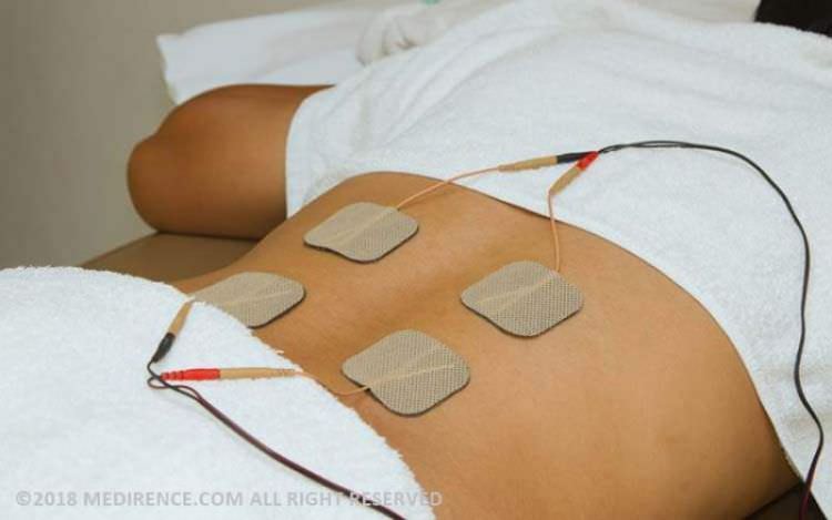 راهنمای خرید دستگاه تحریک الکتریکی عصب از طریق پوست (تنس)